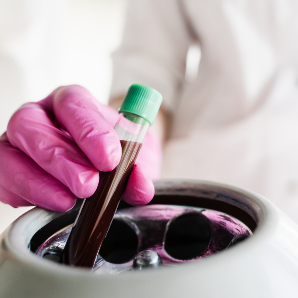 A Centrifuge is used in PRP treatments to separate the Platelet-Rich Plasma from the other components in the blood.