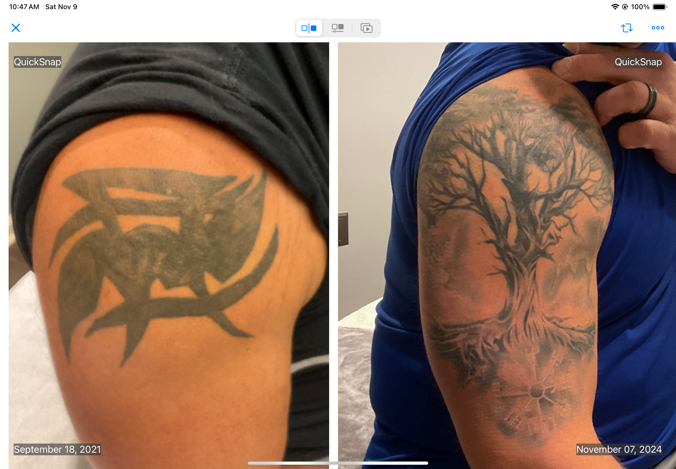 before and after of fading an old tattoo to add a new one